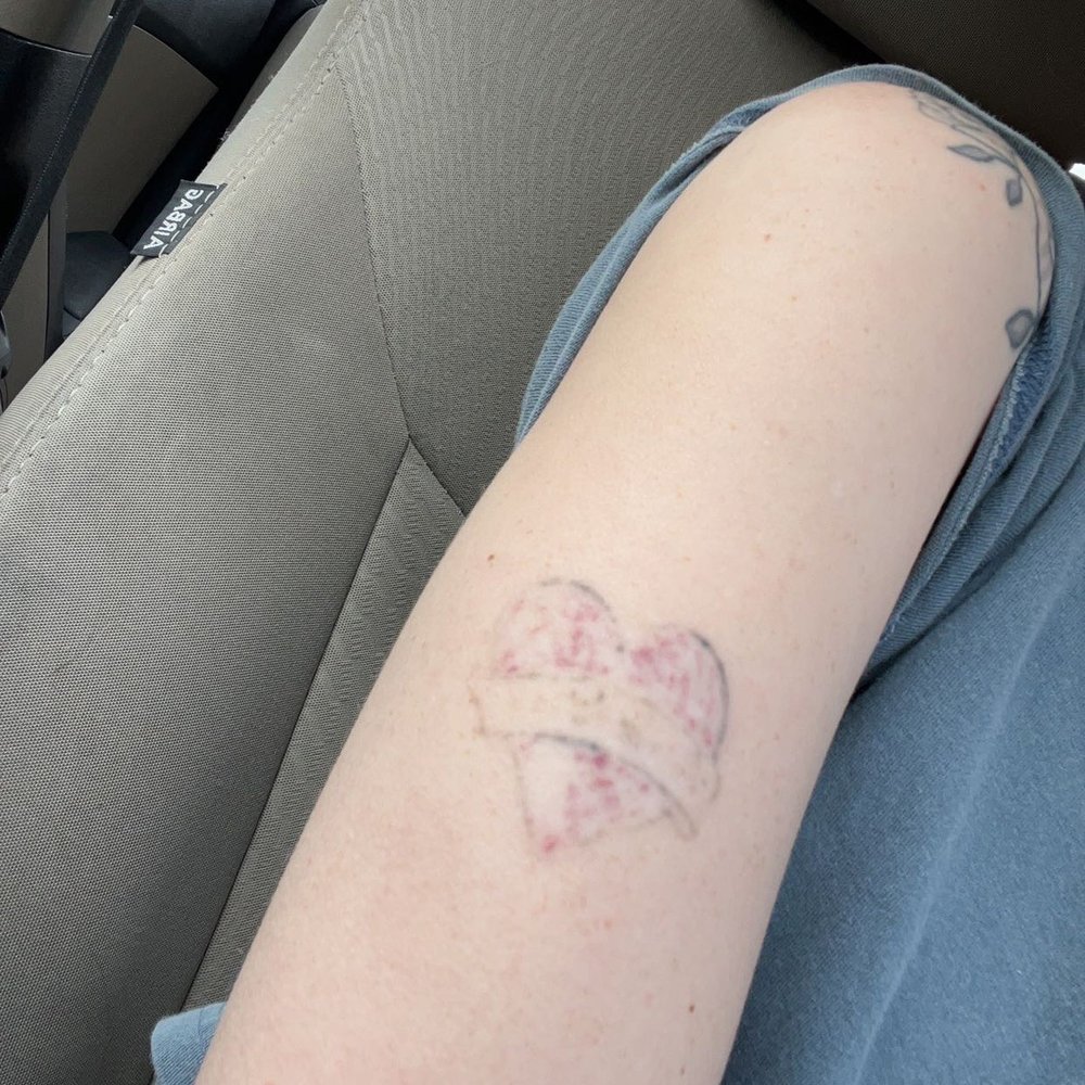 Tattoo before cover up, with tattoo removal Tattoo before cover up, with tattoo removal