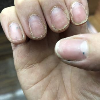 Jasmine Spa Nails - My actual nails before - Nail Salons Near Me - Pasadena, California Jasmine Spa Nails - My actual nails before - Nail Salons Near Me - Pasadena, California