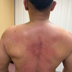 Aflakian Chiropractic Corp. - Here shows all the spots in which I was in so much pain and stress not permitting me of free movement