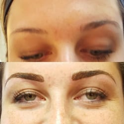 Client says, " pain free."