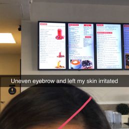 Right eyebrow is uneven, red and irritated Right eyebrow is uneven, red and irritated