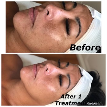 Honeys Skincare - Skin Care Near Me - Riverside, California