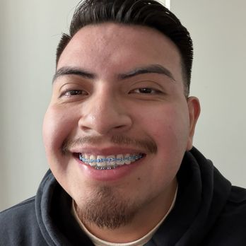Brookhurst Dental Group - Cosmetic Dentists Near Me - Garden Grove, California Brookhurst Dental Group - Cosmetic Dentists Near Me - Garden Grove, California