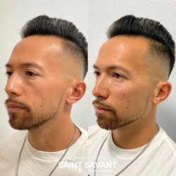 Saint Savant Medical Aesthetics - MALE MIDFACE REFRESH (cheeks+undereyes) using dermal fillers