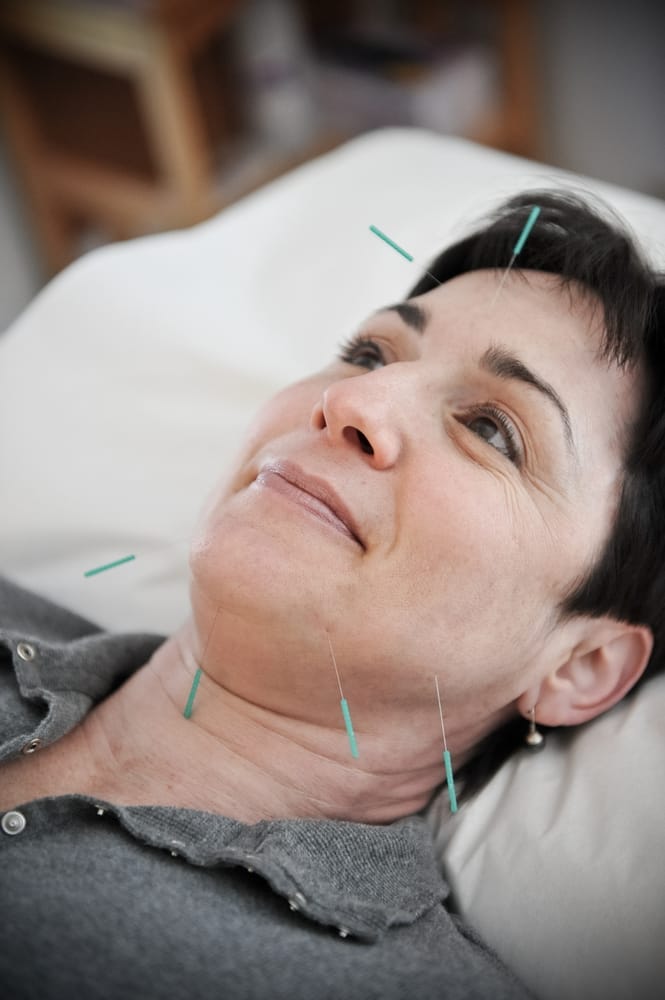 ACUPUNCTURE PARTNERS Updated August 2024 62 Massachusetts Ave