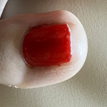 Lovely Nails - This is how she did the polish on every toe. Never made it entirely to the tip of the nail. - Nail Salons Near Me - Prairie Village, Kansas