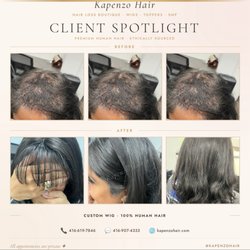 Kapenzo Hair - Hair thinning? Call or text us at 416-907-4333 for a topper or wig
