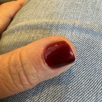 Nails For You - Substantial cuticle lesion - Nail Salons Near Me - Woodinville, Washington