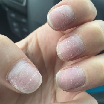 Suncrest Nails - my nails directly after the appointment. - Nail Salons Near Me - Morgantown, West Virginia
