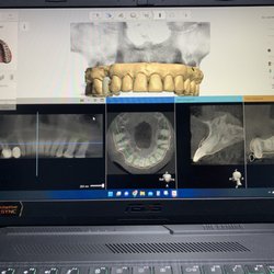 Sonora Dental & Implantes - Planeacion radiológica & digitalización 3D
