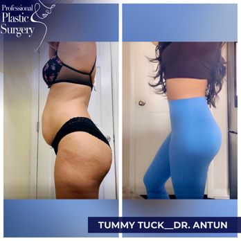 Professional Plastic Surgery - Cosmetic Surgeons Near Me - Miami, Florida Professional Plastic Surgery - Cosmetic Surgeons Near Me - Miami, Florida
