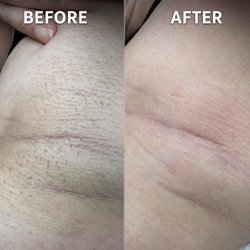 Apex Electrolysis Studio