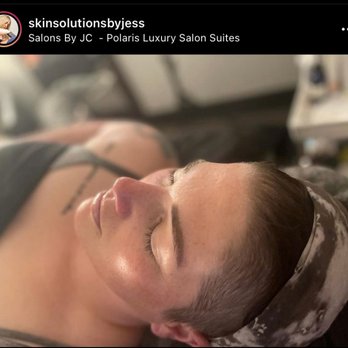 Skin Solutions by Jess - After a 1 hour facial and dermaplaning - Skin Care Near Me - Worthington , Ohio Skin Solutions by Jess - After a 1 hour facial and dermaplaning - Skin Care Near Me - Worthington , Ohio