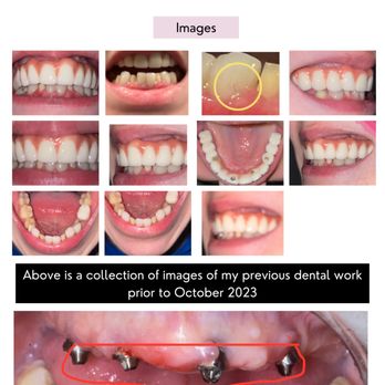 Sani Dental Group - General Dentistry Near Me - Vicente Guerrero, BCN Sani Dental Group - General Dentistry Near Me - Vicente Guerrero, BCN