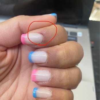 Classic Nails And Spa - Wound on my left index finger - Nail Salons Near Me - Homestead, Florida Classic Nails And Spa - Wound on my left index finger - Nail Salons Near Me - Homestead, Florida