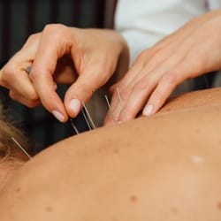 Yintuition Wellness - Acupuncture at Yintuition Wellness