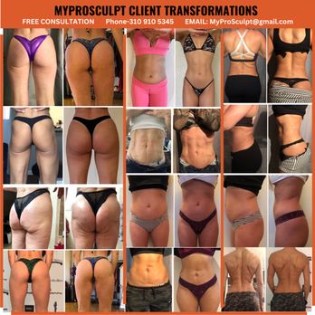 MyProSculpt - Body Contouring Near Me - Denver, Colorado MyProSculpt - Body Contouring Near Me - Denver, Colorado