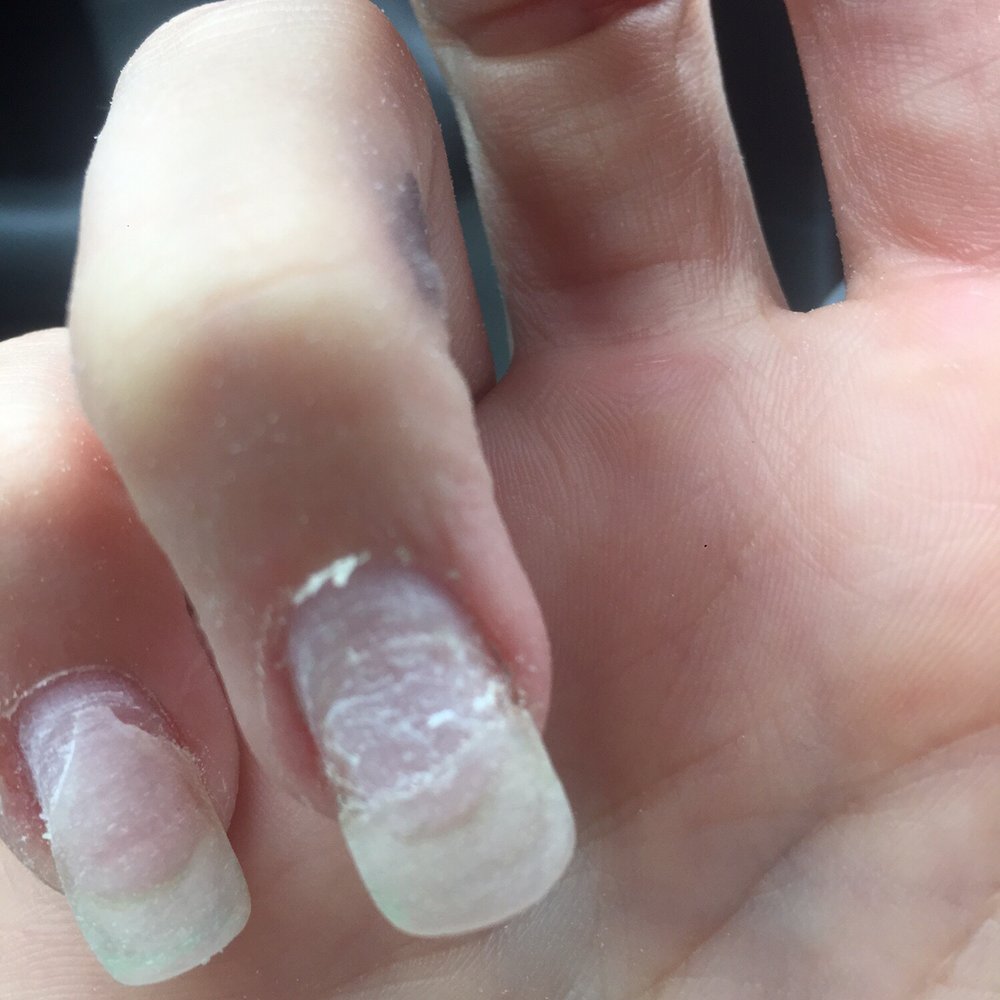 Lavish Nails 2 - Instead of giving me my fill in like I asked, the lady starts chopping the top of my acrylics off and tells me I need a full set - Nail Salons Near Me - Lexington, Kentucky Lavish Nails 2 - Instead of giving me my fill in like I asked, the lady starts chopping the top of my acrylics off and tells me I need a full set - Nail Salons Near Me - Lexington, Kentucky