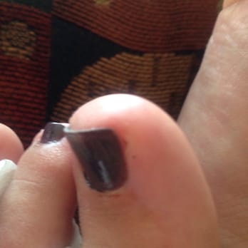 TLC Nails & Spa - The cuts from the cuticle nipper and buffer. - Nail Salons Near Me - Fontana, California
