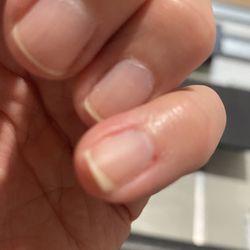 Baraboo Nail Spa - Bleeding from dry nipping