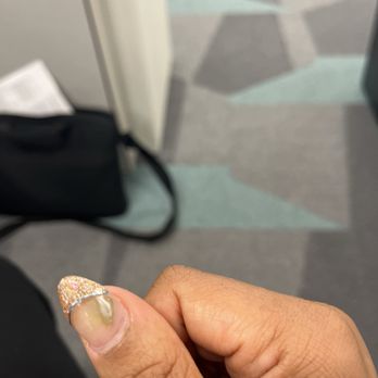 Famous Nails - The fungus/ bacteria infection I got from getting my nails done. - Nail Salons Near Me - Montclair, California