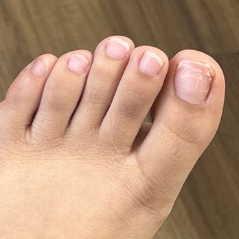 Lovely Nails - He cut my toe and tried to put glue - Nail Salons Near Me - Santa Ana, California Lovely Nails - He cut my toe and tried to put glue - Nail Salons Near Me - Santa Ana, California
