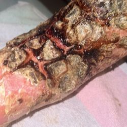 Coast Wound Care