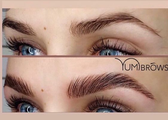 BEYOND SKIN CARE & ELECTROLYSIS - 35 Photos - 46 Wallington Ave