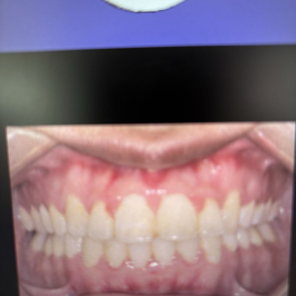 Invisalign Orthodontist Near Me Roosevelt, NY