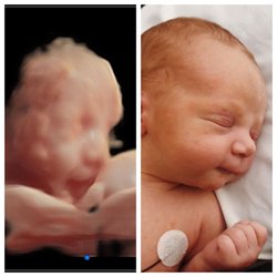 Little Peanut 4D Ultrasound