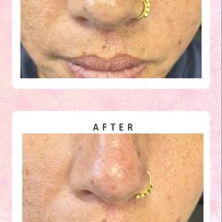 Plush Derma