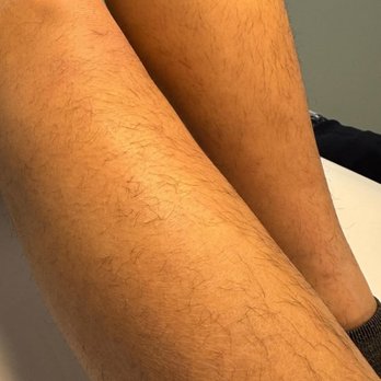 Sugared At Venus - Legs Before & After - Waxing Near Me - Ontario, California Sugared At Venus - Legs Before & After - Waxing Near Me - Ontario, California