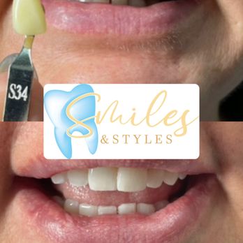 Smiles & Styles - Teeth Whitening Near Me - Houston, Texas Smiles & Styles - Teeth Whitening Near Me - Houston, Texas