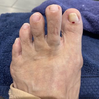 Stella Nails and Spa - Ouch! - Nail Salons Near Me - Converse, Texas