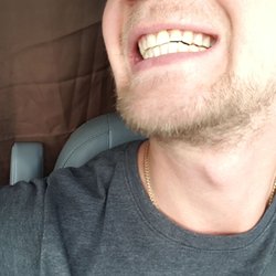 Miami International Mall Dental - My new smile