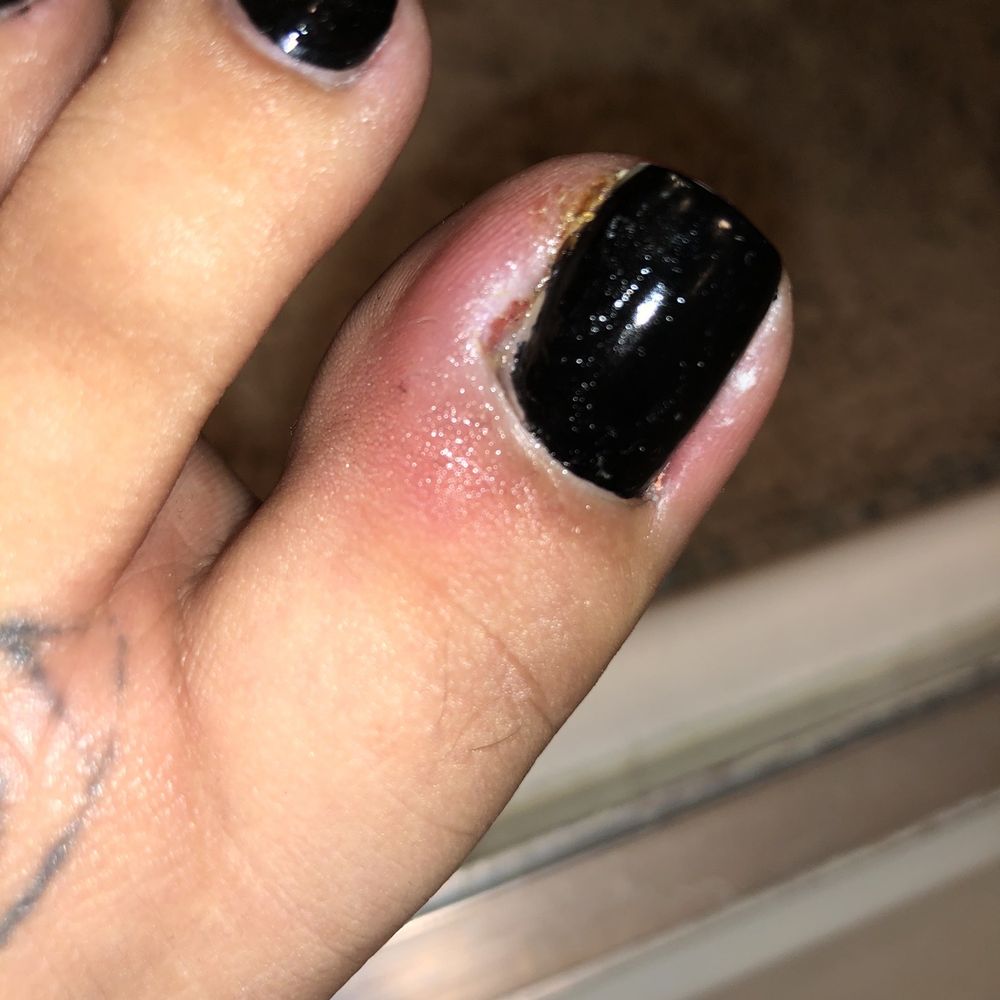 The next day after my pedicure The next day after my pedicure
