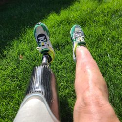 Artisan Technologies - Great looking legs, I'd say! Just look at that prosthesis!