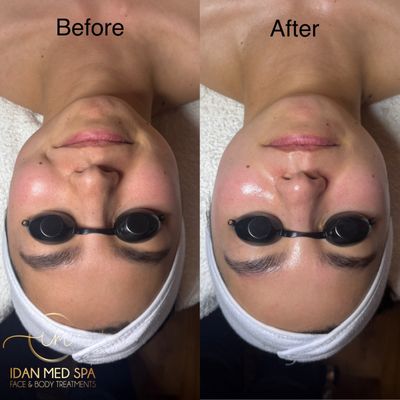 Idan Med Spa by null