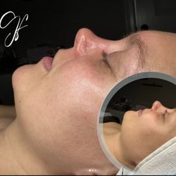 Glow Forth Esthetics - + a @glowforthspa