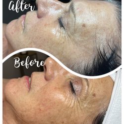 Pretty little faces Body Bar - Nano Infusion Treatment
