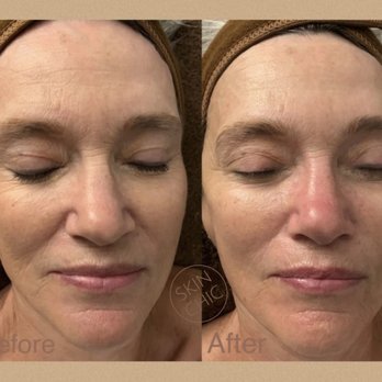 Skin Chic - Luxe Facial & Microdermabrasion - Skin Care Near Me - Phoenix, Arizona Skin Chic - Luxe Facial & Microdermabrasion - Skin Care Near Me - Phoenix, Arizona