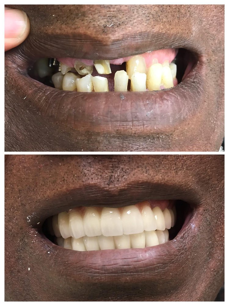 KENSINGTON DENTAL, PC 10 Photos & 10 Reviews 411 Church Ave, Brooklyn, New York General