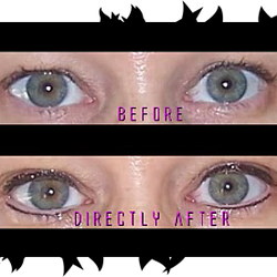 Permanent Effects - Permanent Eyeliner Before/After