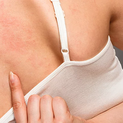Valley Dermatology Clinic