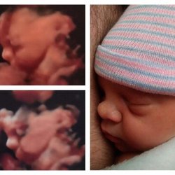 First Glance 3D 4D HD Prenatal Imaging