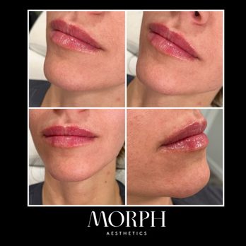 Morph Aesthetics - Aestheticians Near Me - Phoenix, Arizona Morph Aesthetics - Aestheticians Near Me - Phoenix, Arizona