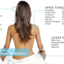 Elite Electrology & Laser Hair Removal - Laser Hair Removal for Men, Women & Teens