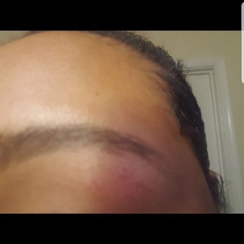 Eyebrow Designer 21 - Bruised and cuts...and eyebrows are still not done right! - Eyebrow Services Near Me - Sterling, Virginia