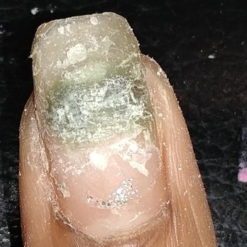 Modern Nails - Fungus from Modern Nail Perry. - Nail Salons Near Me - Perry, Georgia Modern Nails - Fungus from Modern Nail Perry. - Nail Salons Near Me - Perry, Georgia