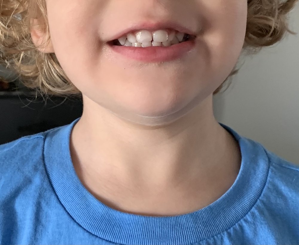 WOOLF DENTAL Updated August 2024 19 Reviews 342 N Val Vista Dr